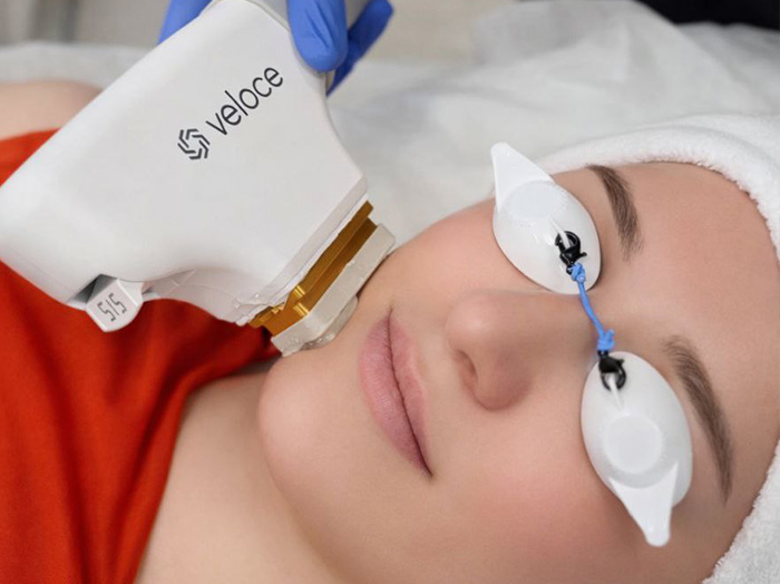 Фотоомоложение