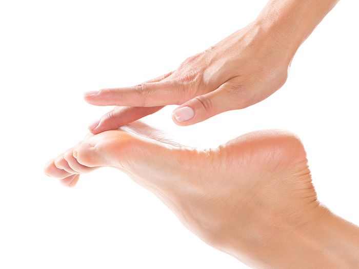 Лечение трещин и сухости пяток