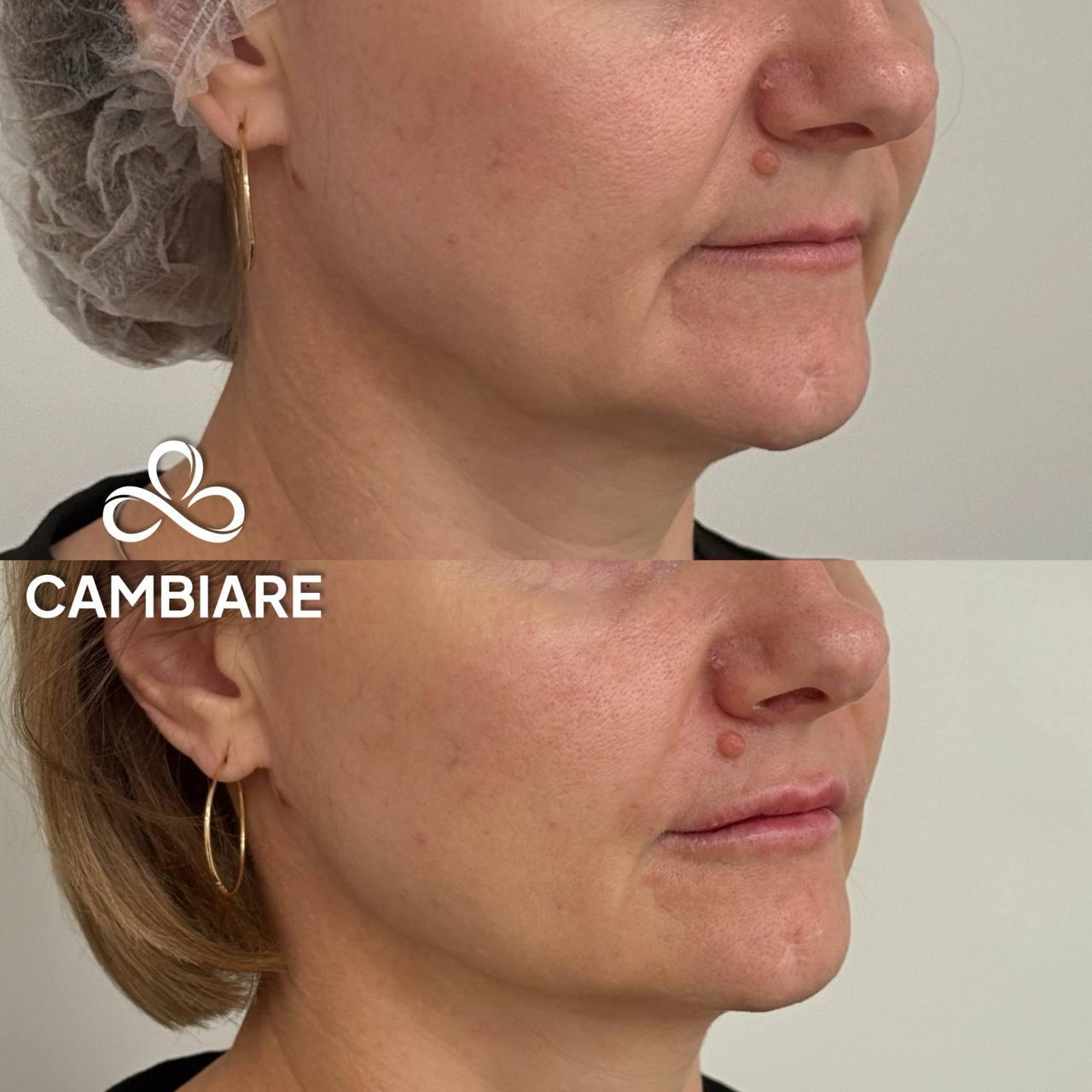 До и после кейс