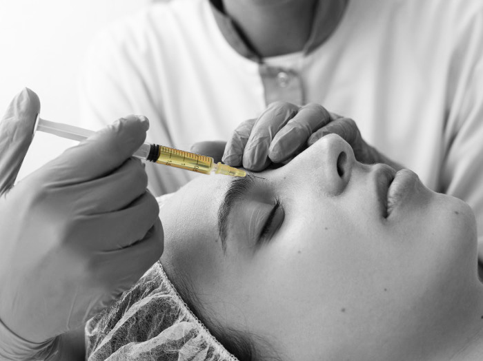 Плазмолифтинг PRP со скидкой -10%