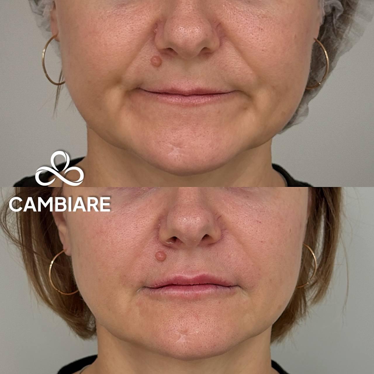 До и после кейс