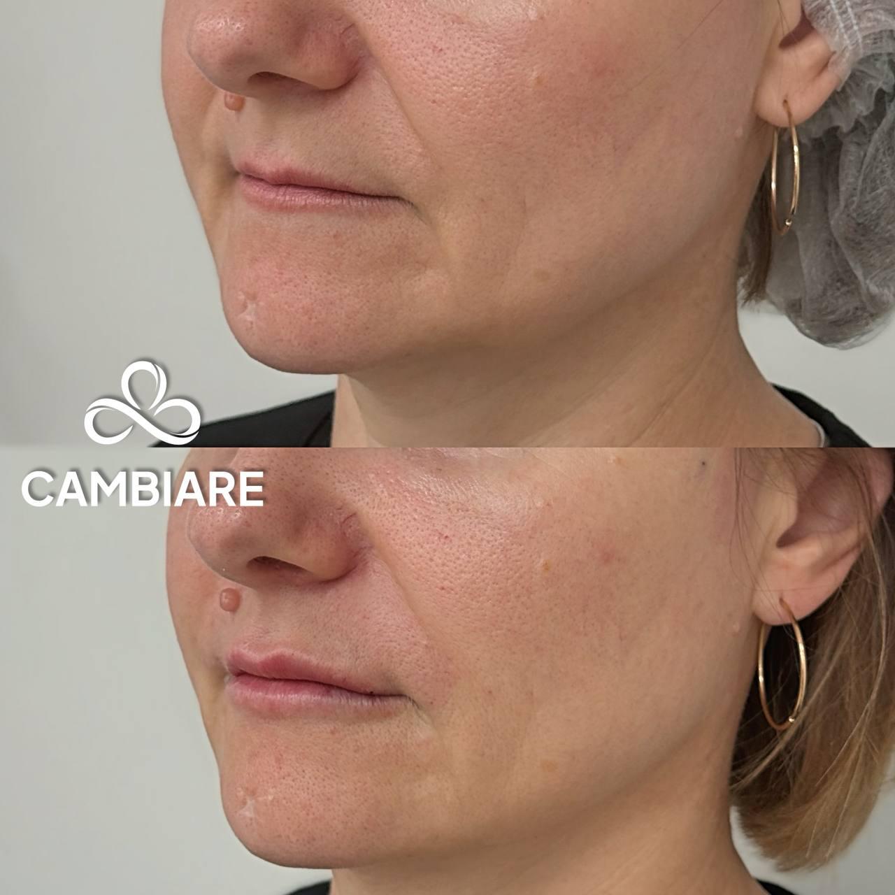 До и после кейс