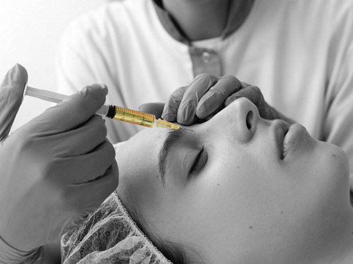 Плазмотерапия PRP